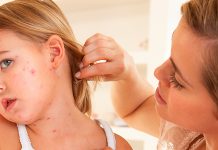 Alergias alimentares: por que elas acontecem?